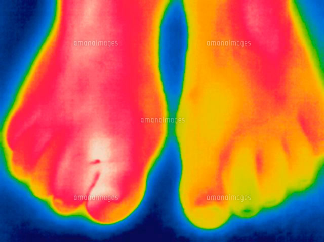 感染したつま先のサーモグラム の写真素材 イラスト素材 アマナイメージズ