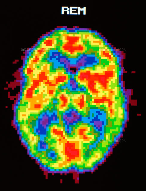 ｒｅｍ睡眠中の人間の脳 の写真素材 イラスト素材 アマナイメージズ
