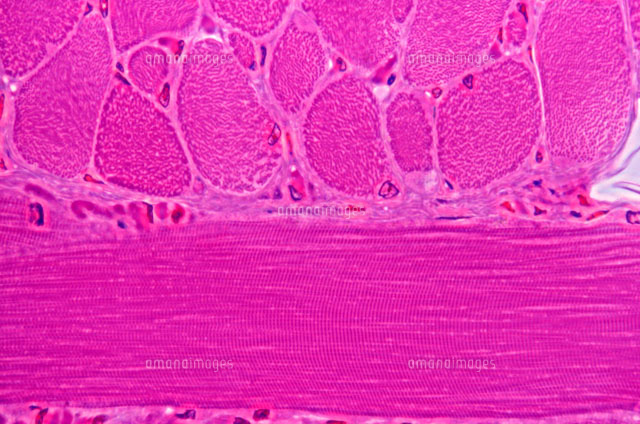 横紋筋 の写真素材 イラスト素材 アマナイメージズ