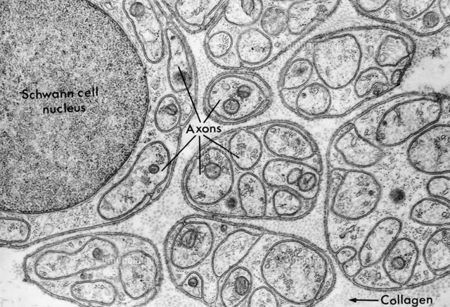 Schwann Cells[01808023983]の写真・イラスト素材｜アマナイメージズ