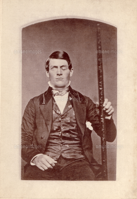 フィネアス P ゲージ アメリカの鉄道技術者 の写真素材 イラスト素材 アマナイメージズ