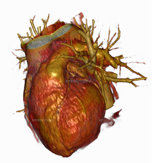 3d Ct Scan Of Heart の写真素材 イラスト素材 アマナイメージズ