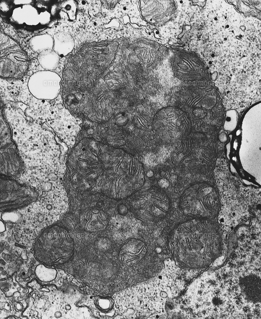 オートファジーリソソーム 透過電子顕微鏡写真 Tem の写真素材 イラスト素材 アマナイメージズ