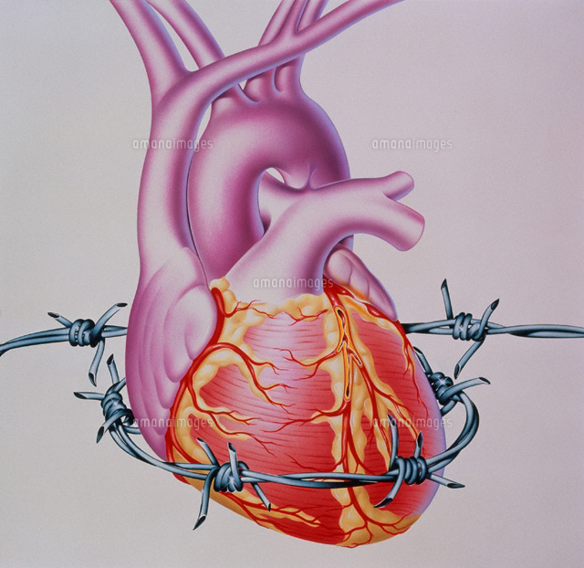 心臓病イメージ の写真素材 イラスト素材 アマナイメージズ