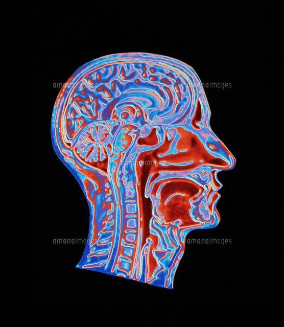脳のctスキャン の写真素材 イラスト素材 アマナイメージズ