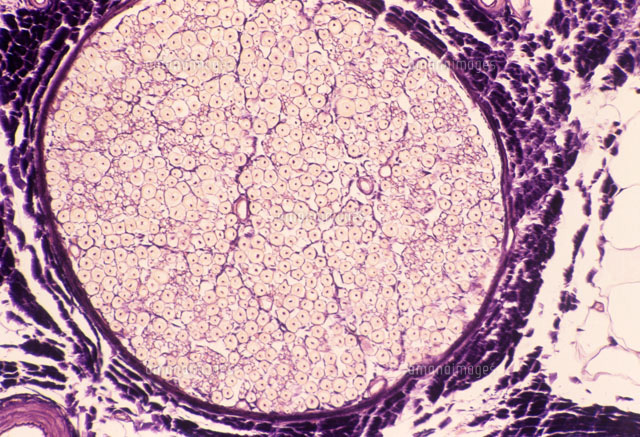 Bundle of nerve fibres， light micrograph[01809014491]の写真素材・イラスト素材｜アマナイメージズ