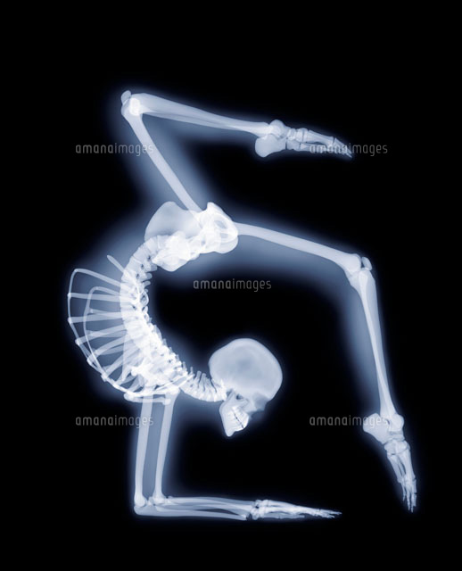 エルボースタンド (X線写真によるアートワーク)[01809018234]の写真