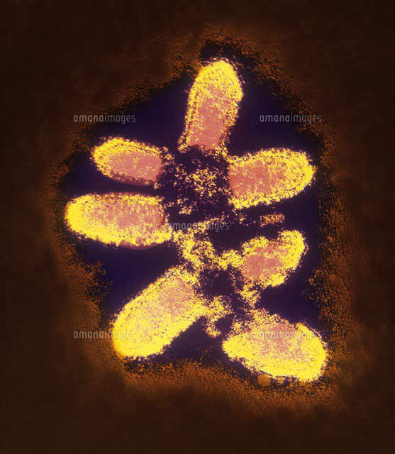 False-col TEM of rabies virus particles[01809020407]の写真素材・イラスト素材｜アマナイメージズ