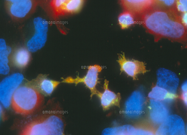 Human natural killer cells attacking cancer cells[01809035930]の写真素材 ...