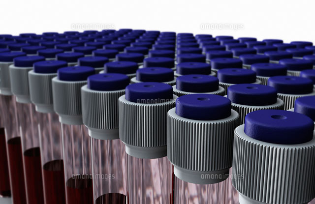 Multiple blood sample tubes-60[20049001447]の写真素材・イラスト素材｜アマナイメージズ
