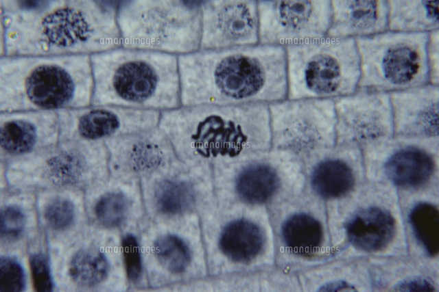 オオカナダモの原形質分離 ショ糖15 溶液 顕微鏡倍率 の写真素材 イラスト素材 アマナイメージズ