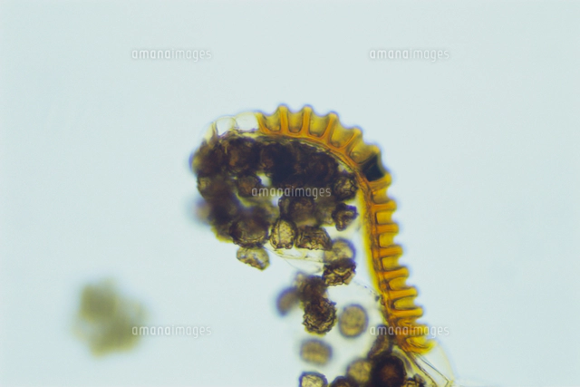 イヌワラビの胞子のう 顕微鏡倍率×100[32217000320]の写真・イラスト