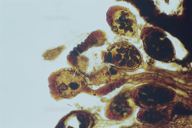 イヌワラビの胞子のう 顕微鏡倍率×100[32217000320]の写真・イラスト