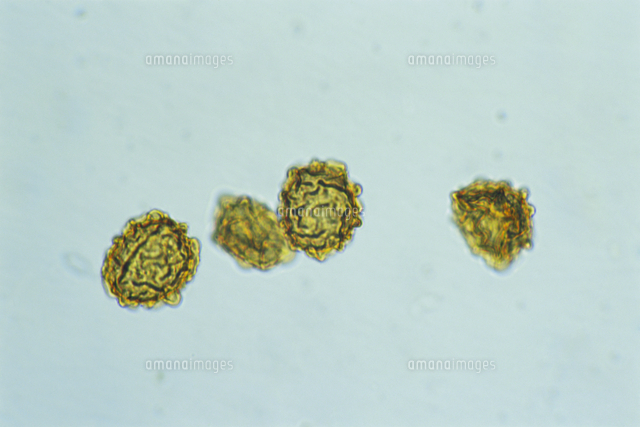 空*草様 ★ヘイケイヌワラビ　島根県産　胞子培養株 イヌワラビの胞子 顕微鏡倍率×400[32217000321]の写真・イラスト素材