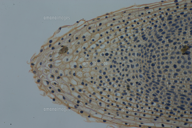 タマネギの成長点 根 撮影倍率 33倍 撮像画面 22 の写真素材 イラスト素材 アマナイメージズ