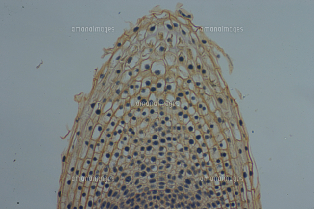 タマネギの成長点 根 撮影倍率 33倍 撮像画面 22 の写真素材 イラスト素材 アマナイメージズ