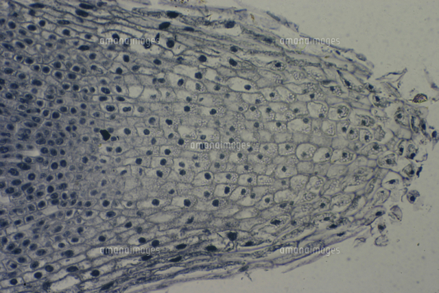 ソラマメの成長点 根 撮影倍率 33倍 撮像画面 22 の写真素材 イラスト素材 アマナイメージズ