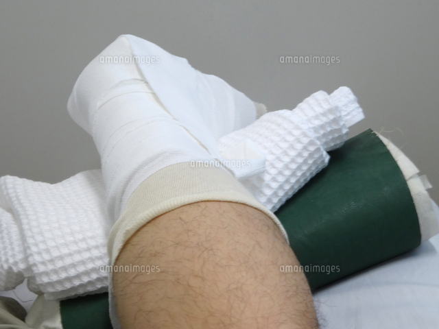 足首骨折のギブス の写真素材 イラスト素材 アマナイメージズ