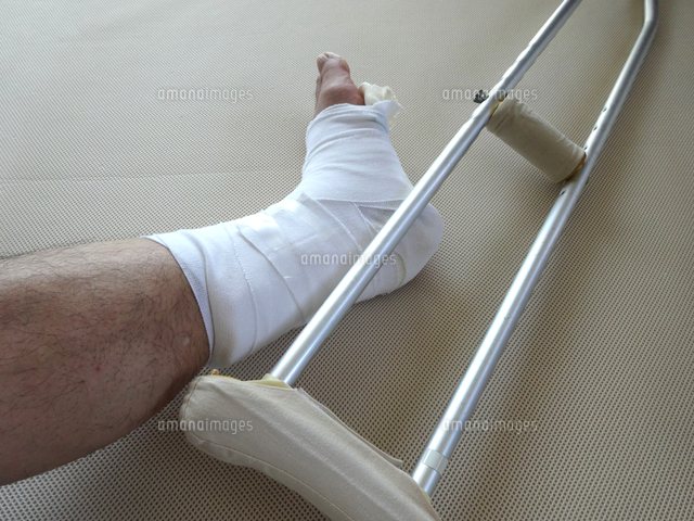 足首骨折のギブス の写真素材 イラスト素材 アマナイメージズ