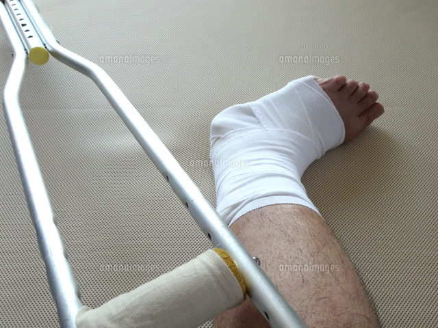 足首骨折のギブス の写真素材 イラスト素材 アマナイメージズ