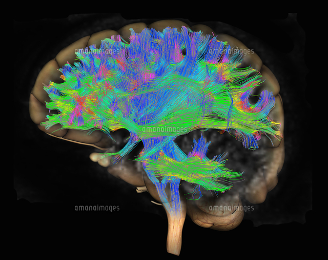Diffusion MRI, also referred to as diffusion tensor imaging or DTI
